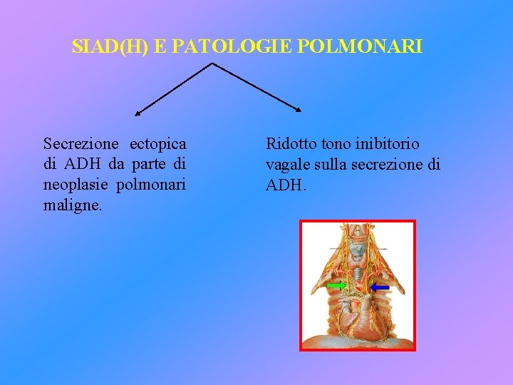 SIAD(H) E PATOLOGIE POLMONARI Secrezione ectopica di ADH da parte di neoplasie polmonari maligne.
