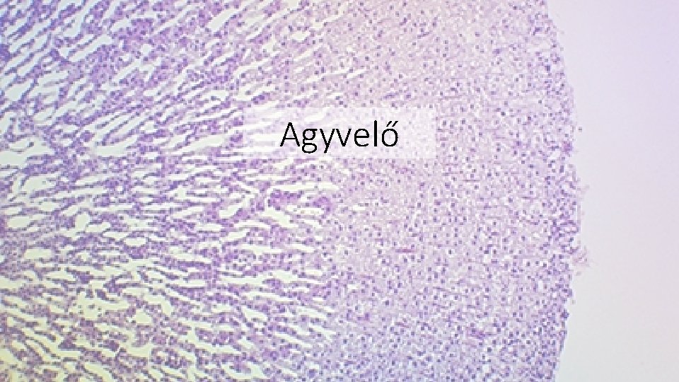 Agyvelő 
