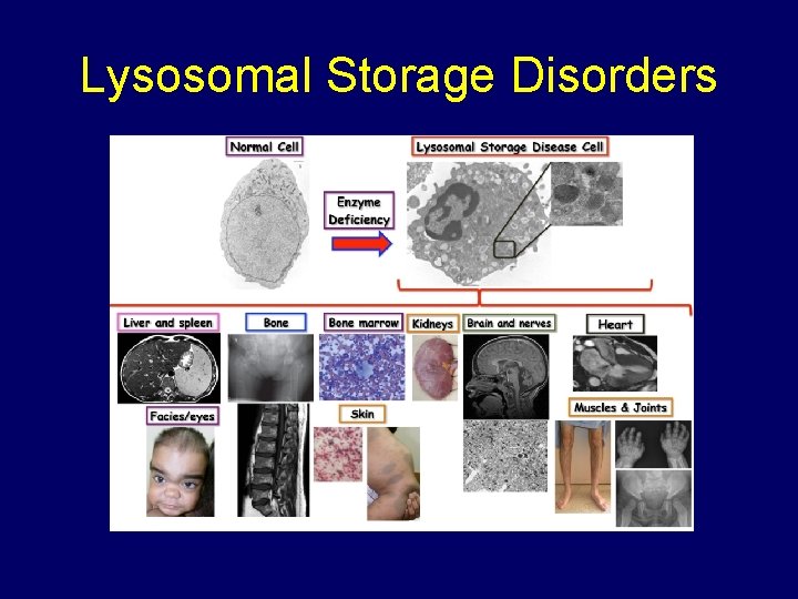 Lysosomal Storage Disorders 