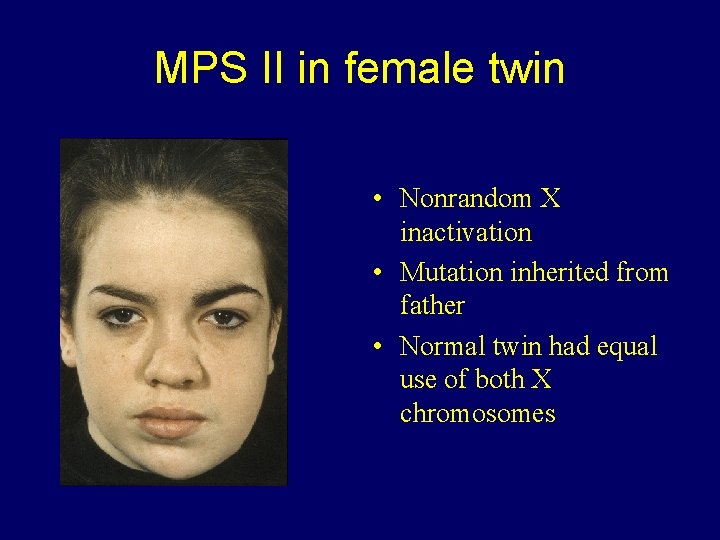 MPS II in female twin • Nonrandom X inactivation • Mutation inherited from father