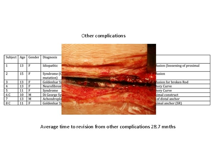 Other complications Average time to revision from other complications 28. 7 mnths 