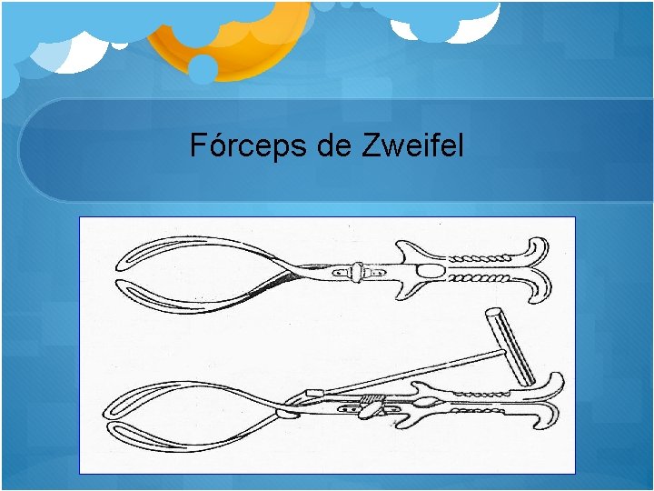 Fórceps de Zweifel 