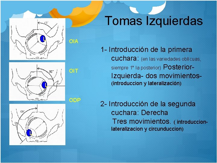 Tomas Izquierdas L OIA OIT (introduccion y lateralización) L ODP L 1 - Introducción