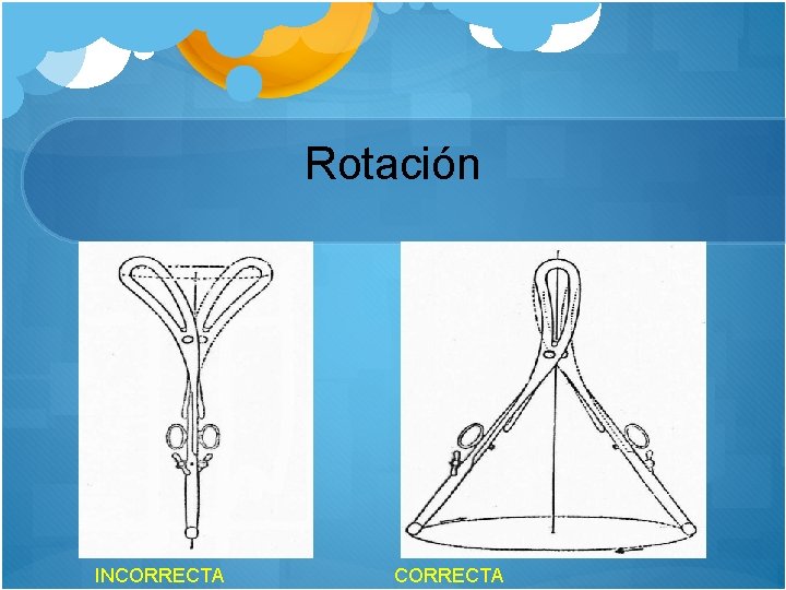 Rotación INCORRECTA 