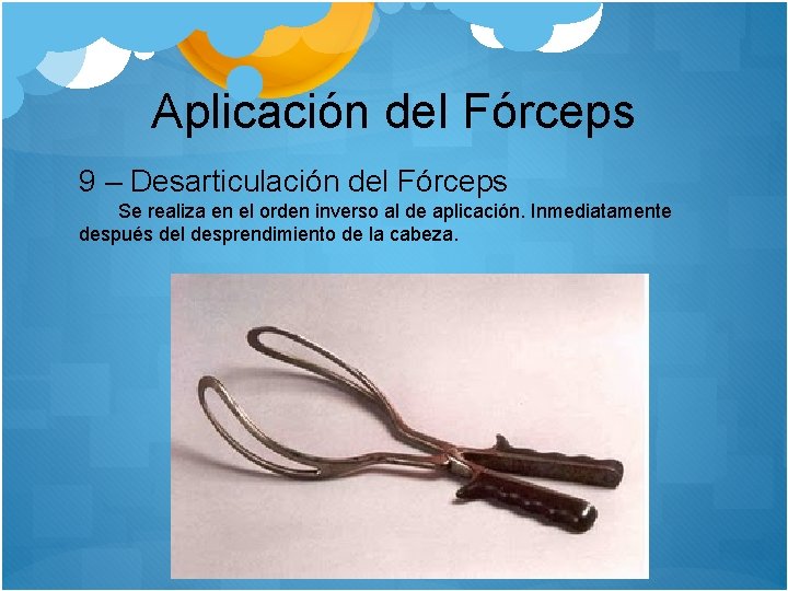 Aplicación del Fórceps 9 – Desarticulación del Fórceps Se realiza en el orden inverso