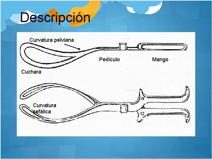 Descripción Curvatura pelviana Pedículo Cuchara Curvatura cefálica Mango 