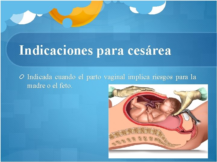 Indicaciones para cesárea Indicada cuando el parto vaginal implica riesgos para la madre o