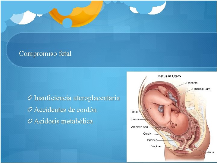 Compromiso fetal Insuficiencia uteroplacentaria Accidentes de cordón Acidosis metabólica 