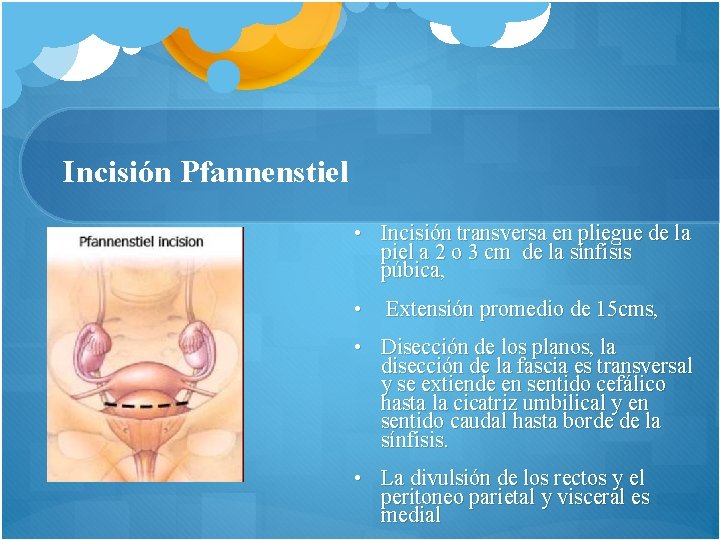 Incisión Pfannenstiel • Incisión transversa en pliegue de la piel a 2 o 3