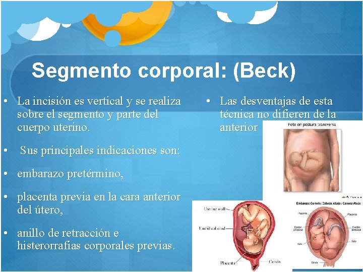 Segmento corporal: (Beck) • La incisión es vertical y se realiza sobre el segmento