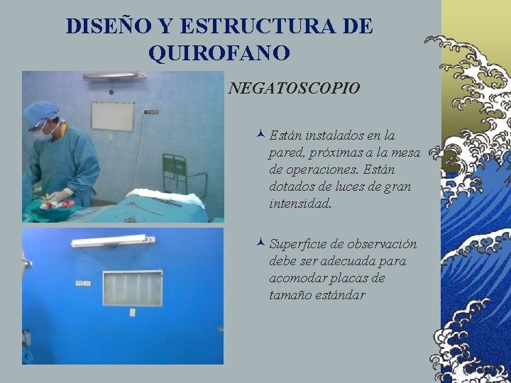 DISEÑO Y ESTRUCTURA DE QUIROFANO NEGATOSCOPIO © Están instalados en la pared, próximas a DISEÑO Y ESTRUCTURA DE QUIROFANO NEGATOSCOPIO © Están instalados en la pared, próximas a