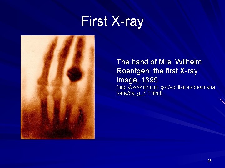 First X-ray The hand of Mrs. Wilhelm Roentgen: the first X-ray image, 1895 (http: