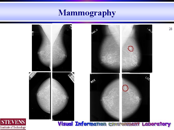 Mammography 28 