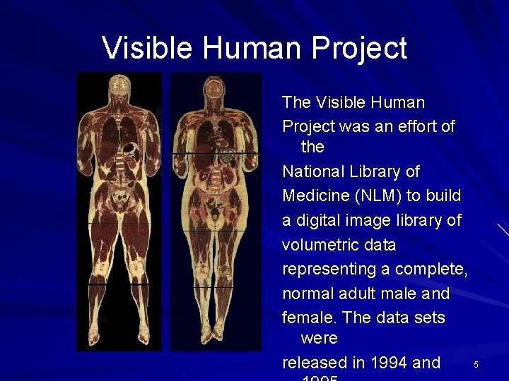 Visible Human Project The Visible Human Project was an effort of the National Library