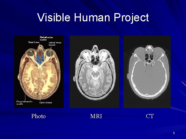 Visible Human Project Photo MRI CT 6 