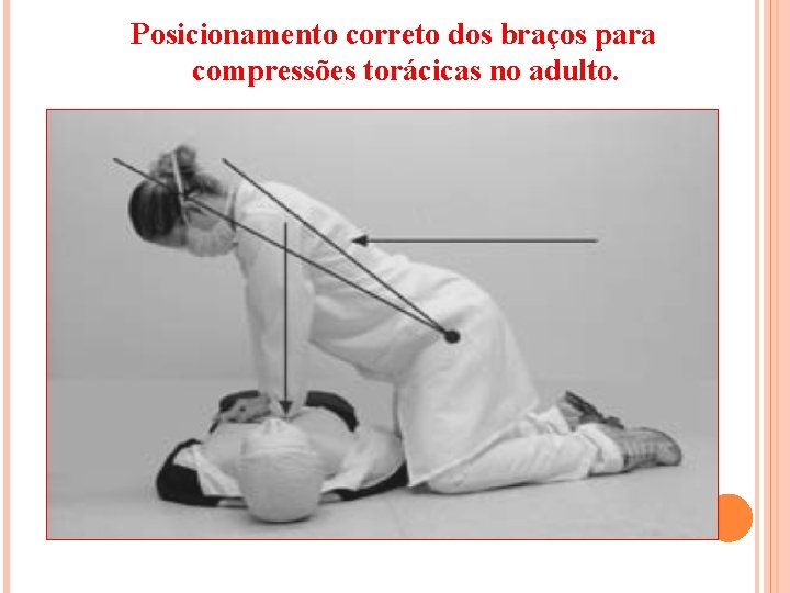  Posicionamento correto dos braços para compressões torácicas no adulto. 