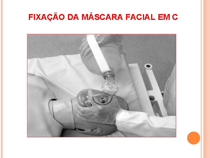 FIXAÇÃO DA MÁSCARA FACIAL EM C 