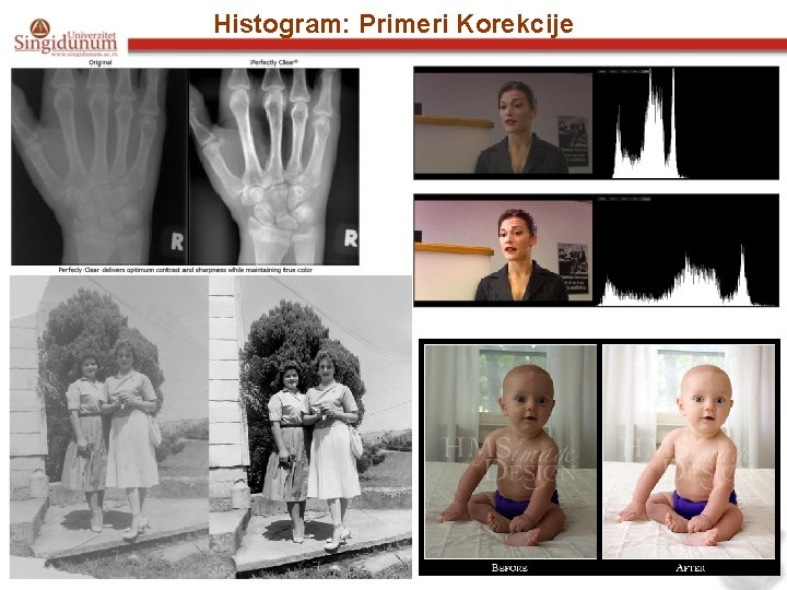 Histogram: Primeri Korekcije 