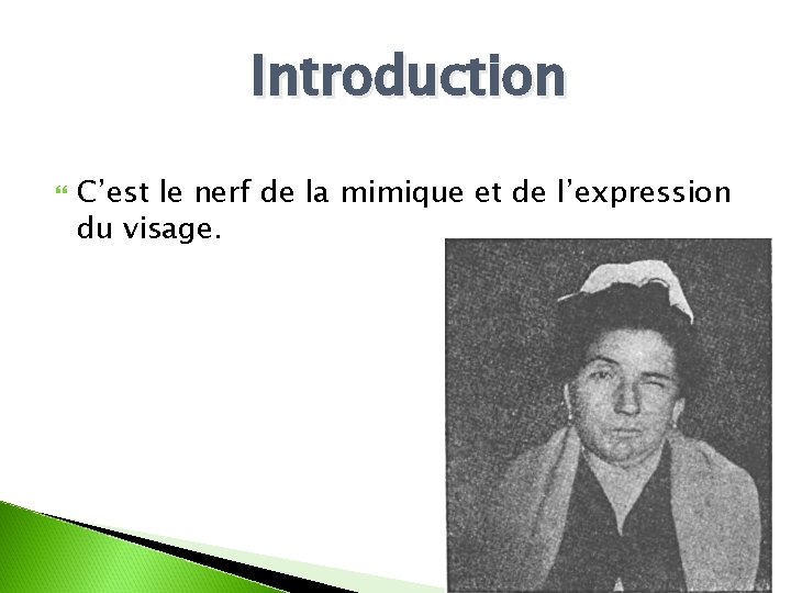 Introduction C’est le nerf de la mimique et de l’expression du visage. Dr Soussa