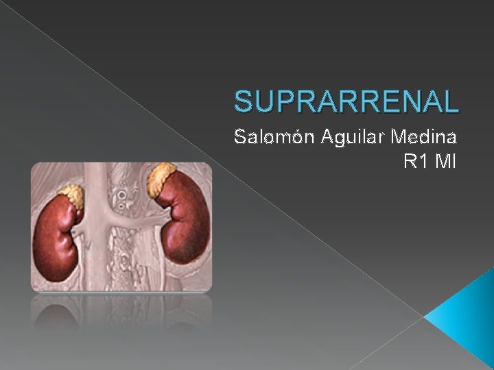 SUPRARRENAL Salomón Aguilar Medina R 1 MI 