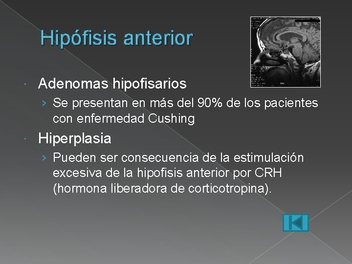 Hipófisis anterior Adenomas hipofisarios › Se presentan en más del 90% de los pacientes