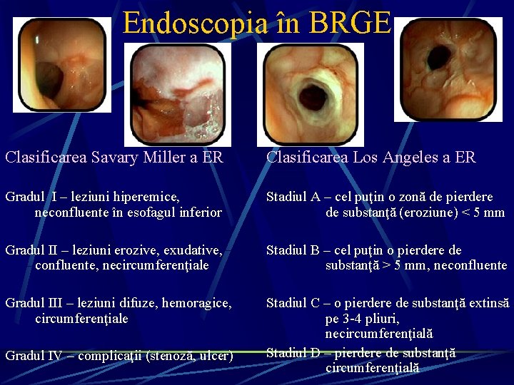 Endoscopia în BRGE Clasificarea Savary Miller a ER Clasificarea Los Angeles a ER Gradul