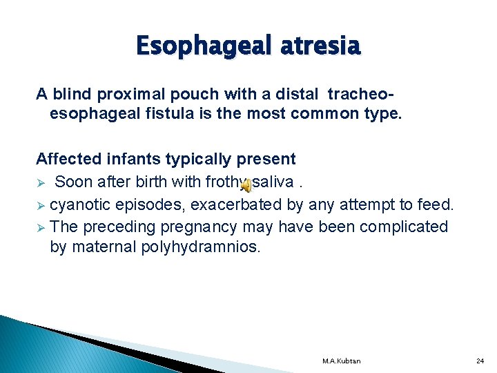 Esophageal atresia A blind proximal pouch with a distal tracheoesophageal fistula is the most