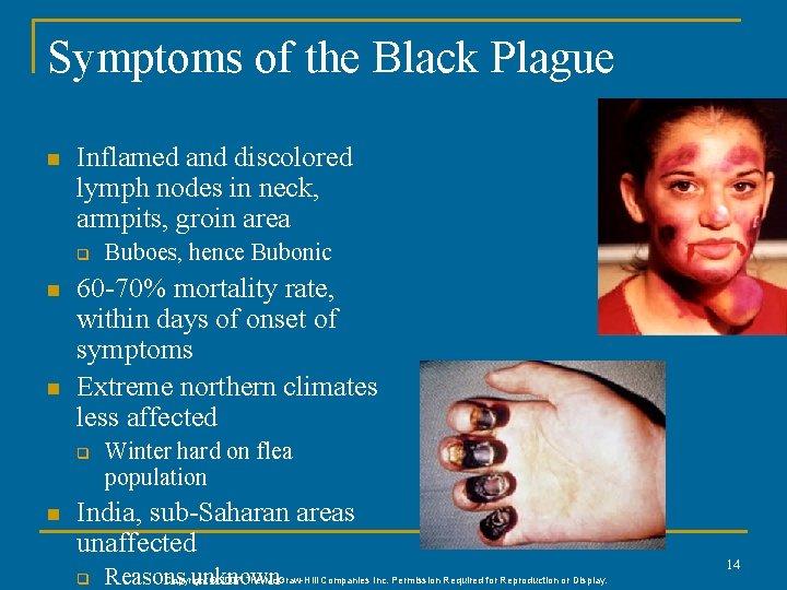 Symptoms of the Black Plague n Inflamed and discolored lymph nodes in neck, armpits,