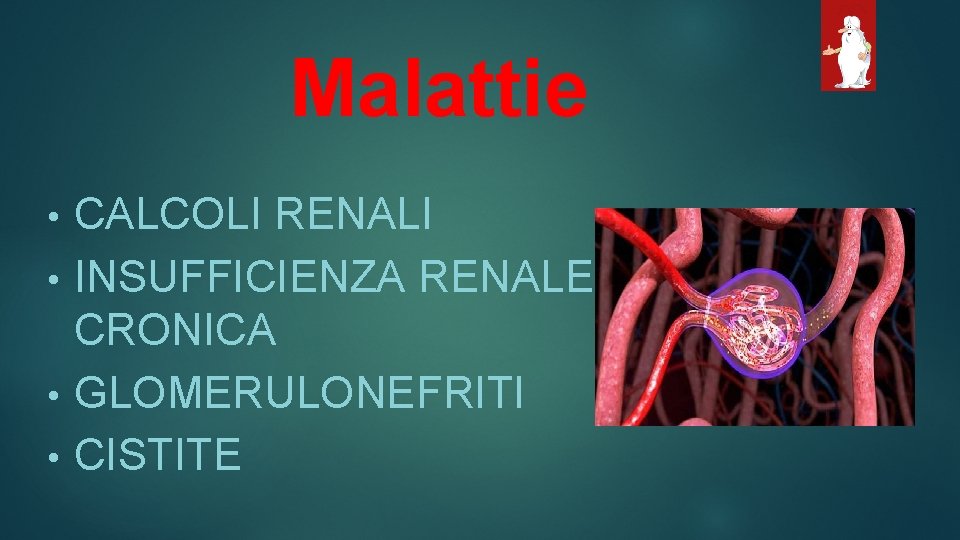 Malattie CALCOLI RENALI • INSUFFICIENZA RENALE CRONICA • GLOMERULONEFRITI • CISTITE • 