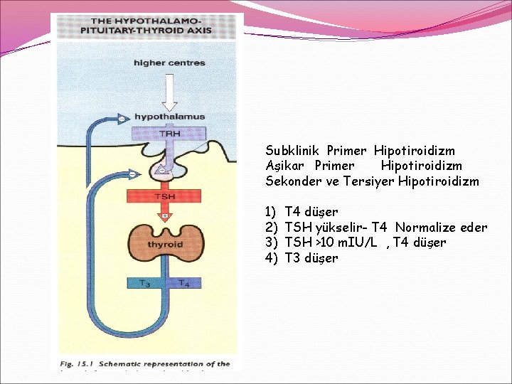 Subklinik Primer Hipotiroidizm Aşikar Primer Hipotiroidizm Sekonder ve Tersiyer Hipotiroidizm 1) 2) 3) 4) Subklinik Primer Hipotiroidizm Aşikar Primer Hipotiroidizm Sekonder ve Tersiyer Hipotiroidizm 1) 2) 3) 4)