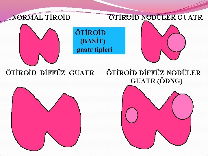 NORMAL TİROİD ÖTİROİD NODÜLER GUATR ÖTİROİD (BASİT) guatr tipleri ÖTİROİD DİFFÜZ GUATR ÖTİROİD DİFFÜZ NORMAL TİROİD ÖTİROİD NODÜLER GUATR ÖTİROİD (BASİT) guatr tipleri ÖTİROİD DİFFÜZ GUATR ÖTİROİD DİFFÜZ