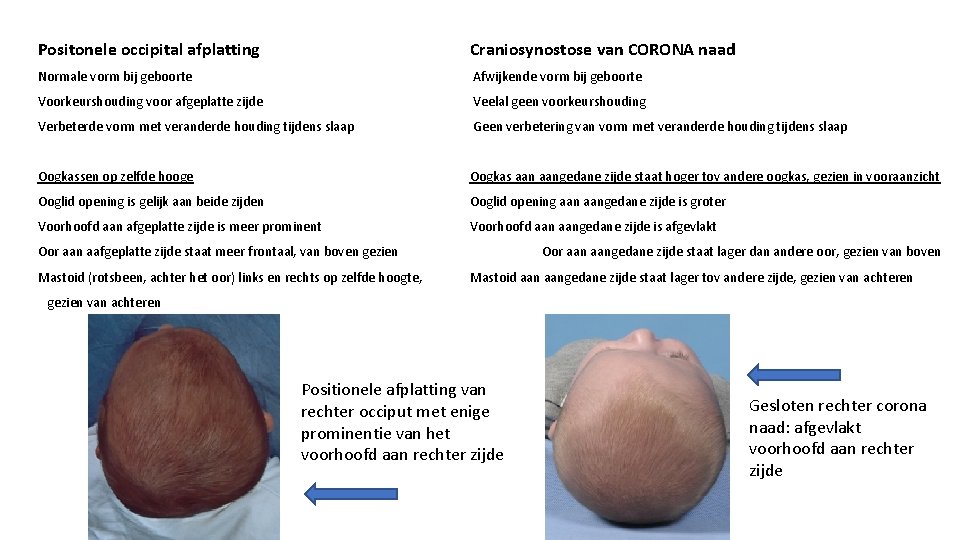Positonele occipital afplatting Craniosynostose van CORONA naad Normale vorm bij geboorte Afwijkende vorm bij