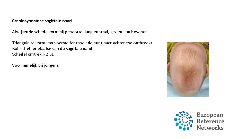 Craniosynostose sagittale naad Afwijkende schedelvorm bij geboorte: lang en smal, gezien van bovenaf Triangulaire