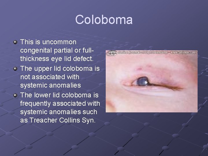 Coloboma This is uncommon congenital partial or fullthickness eye lid defect. The upper lid