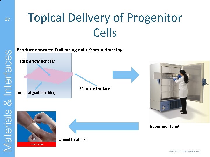 #2 Topical Delivery of Progenitor Cells Product concept: Delivering cells from a dressing adult