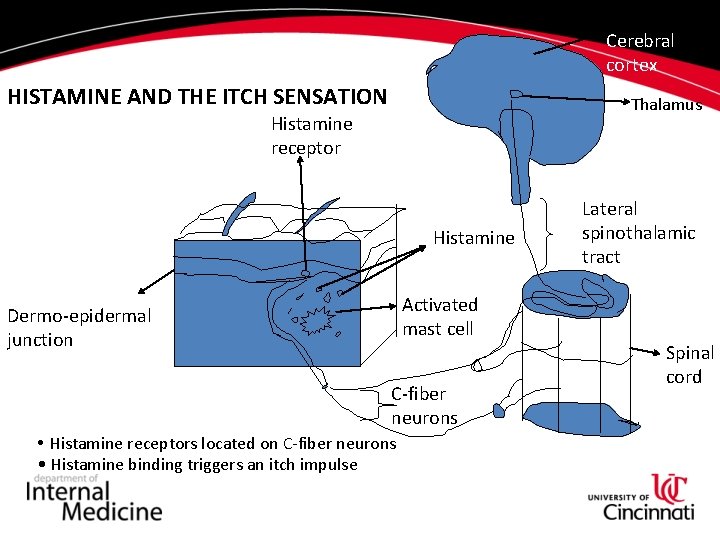 Cerebral cortex HISTAMINE AND THE ITCH SENSATION Thalamus Histamine receptor Histamine Activated mast cell Cerebral cortex HISTAMINE AND THE ITCH SENSATION Thalamus Histamine receptor Histamine Activated mast cell