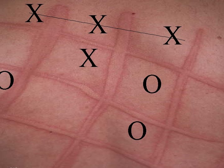 O X ______ X X ______ ______ X ______ _ O O sitesearch: exact O X ______ X X ______ ______ X ______ _ O O sitesearch: exact