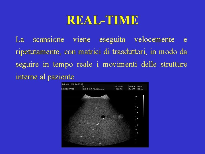 REAL-TIME La scansione viene eseguita velocemente e ripetutamente, con matrici di trasduttori, in modo