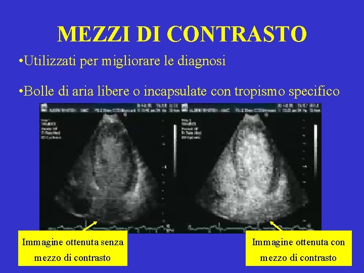 MEZZI DI CONTRASTO • Utilizzati per migliorare le diagnosi • Bolle di aria libere