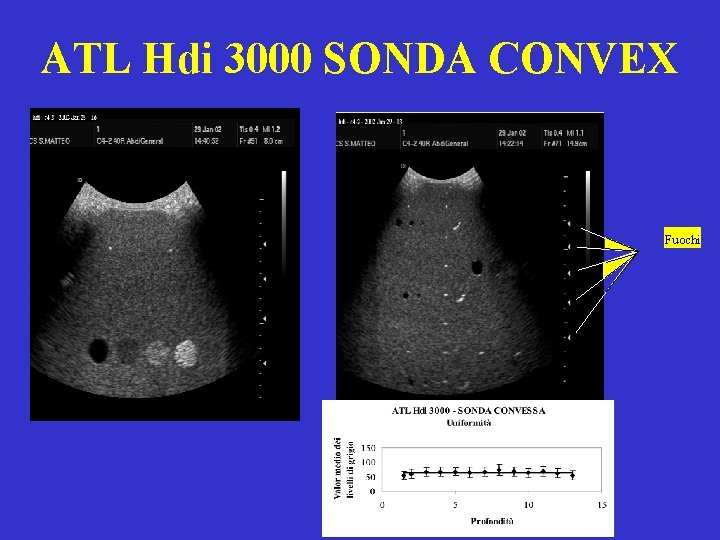 ATL Hdi 3000 SONDA CONVEX Fuochi 