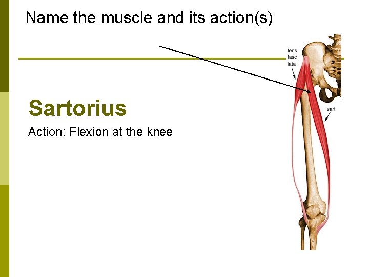 Name the muscle and its action(s) Sartorius Action: Flexion at the knee 