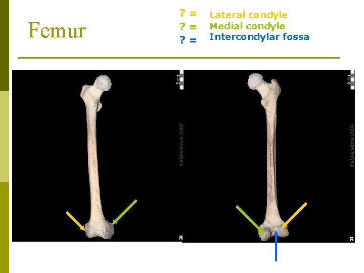 Femur ? = ? = Lateral condyle Medial condyle Intercondylar fossa 