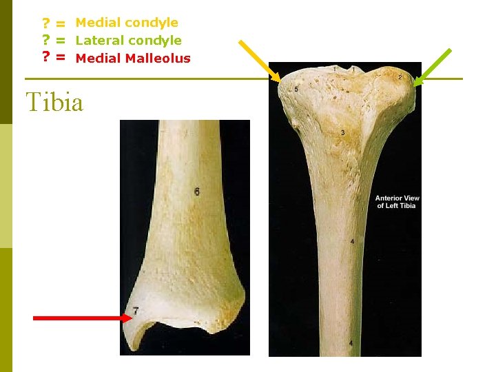 ? = Medial condyle ? = Lateral condyle ? = Medial Malleolus Tibia 