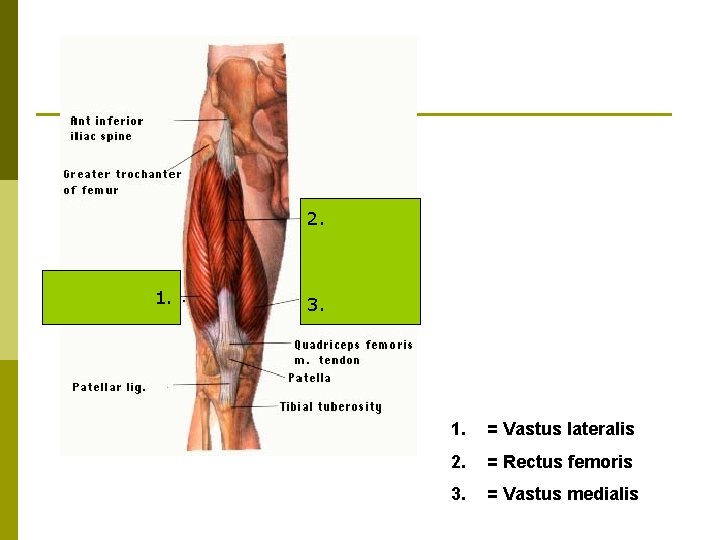 2. 1. 3. 1. = Vastus lateralis 2. = Rectus femoris 3. = Vastus