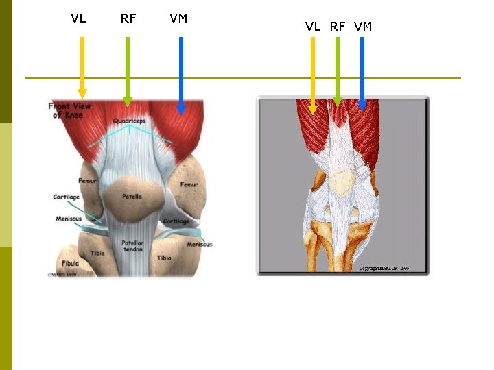 VL RF VM 