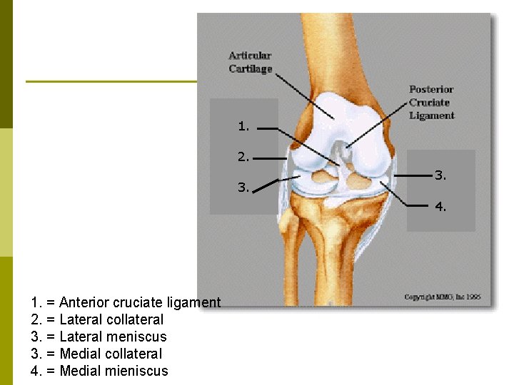 1. 2. 3. 4. 1. = Anterior cruciate ligament 2. = Lateral collateral 3.