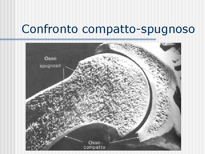 Confronto compatto-spugnoso 