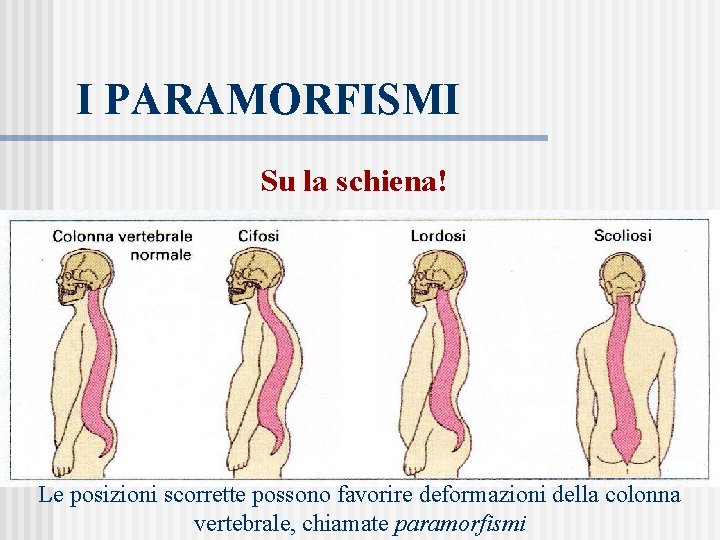 I PARAMORFISMI Su la schiena! Le posizioni scorrette possono favorire deformazioni della colonna vertebrale,