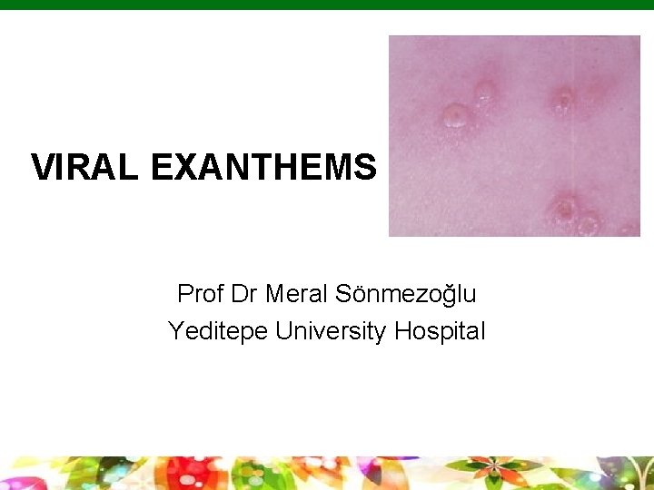 VIRAL EXANTHEMS Prof Dr Meral Sönmezoğlu Yeditepe University Hospital Copyright © 2010 Pearson Education,