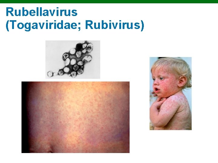 Rubellavirus (Togaviridae; Rubivirus) Copyright © 2010 Pearson Education, Inc. 